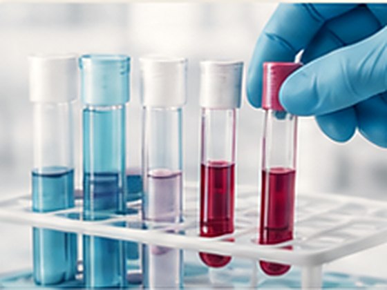 Blood sample tubes being handled in the laboratory